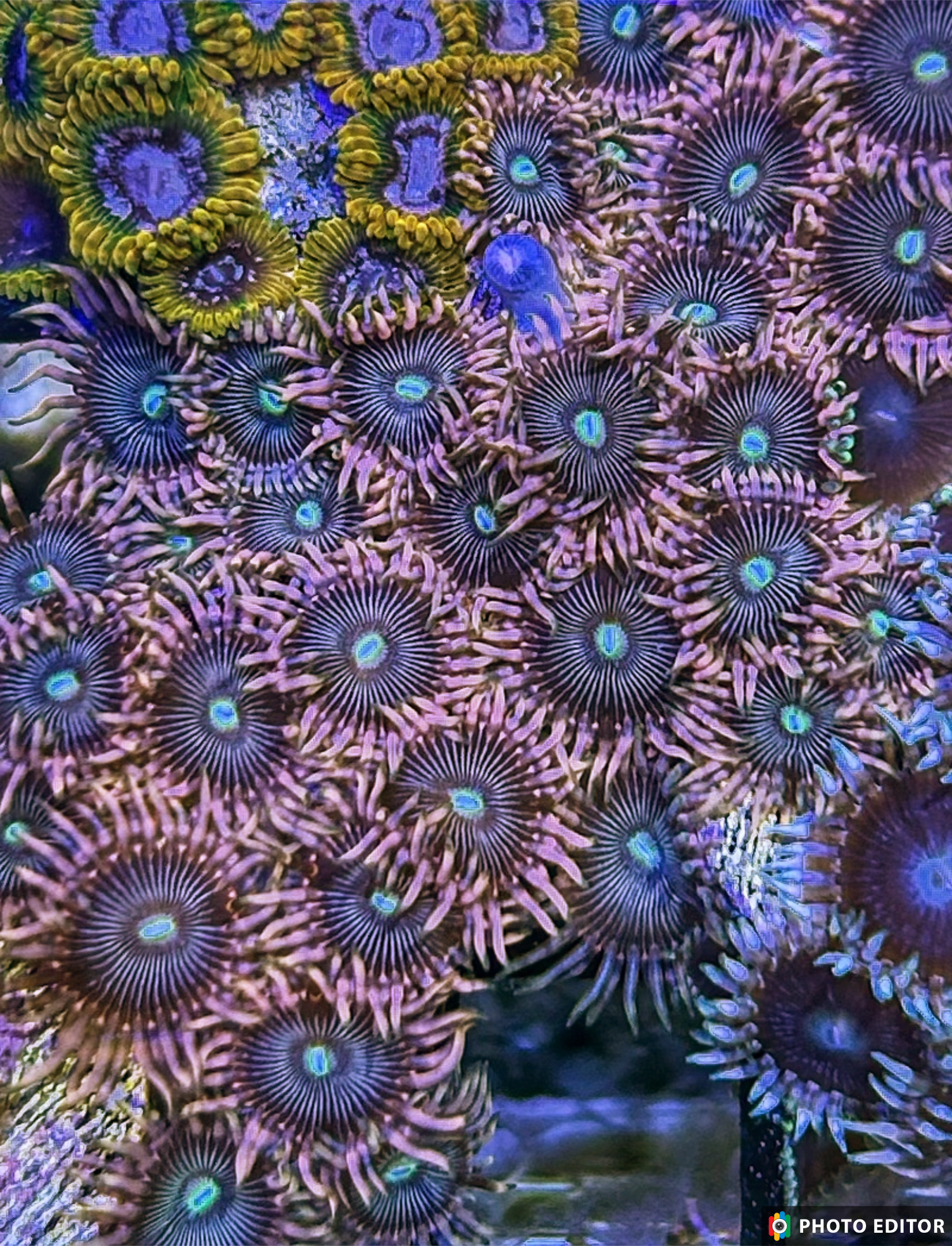 Asian Boobies 2 Polyps